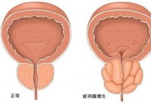 ǰĲ